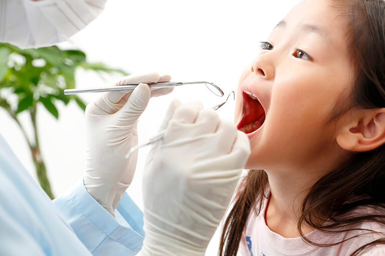 お子様の虫歯の予防